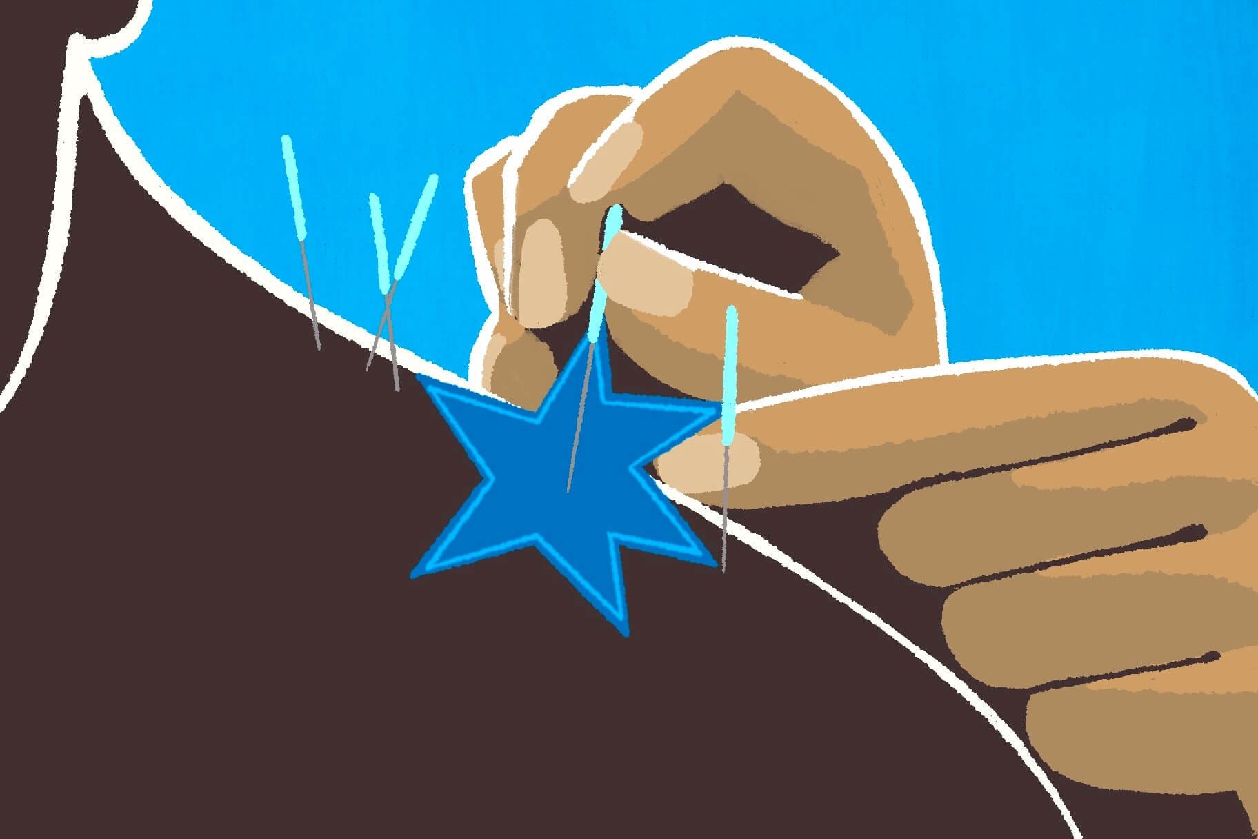 Dry Needling vs. Acupuncture: Everything You Need to Know