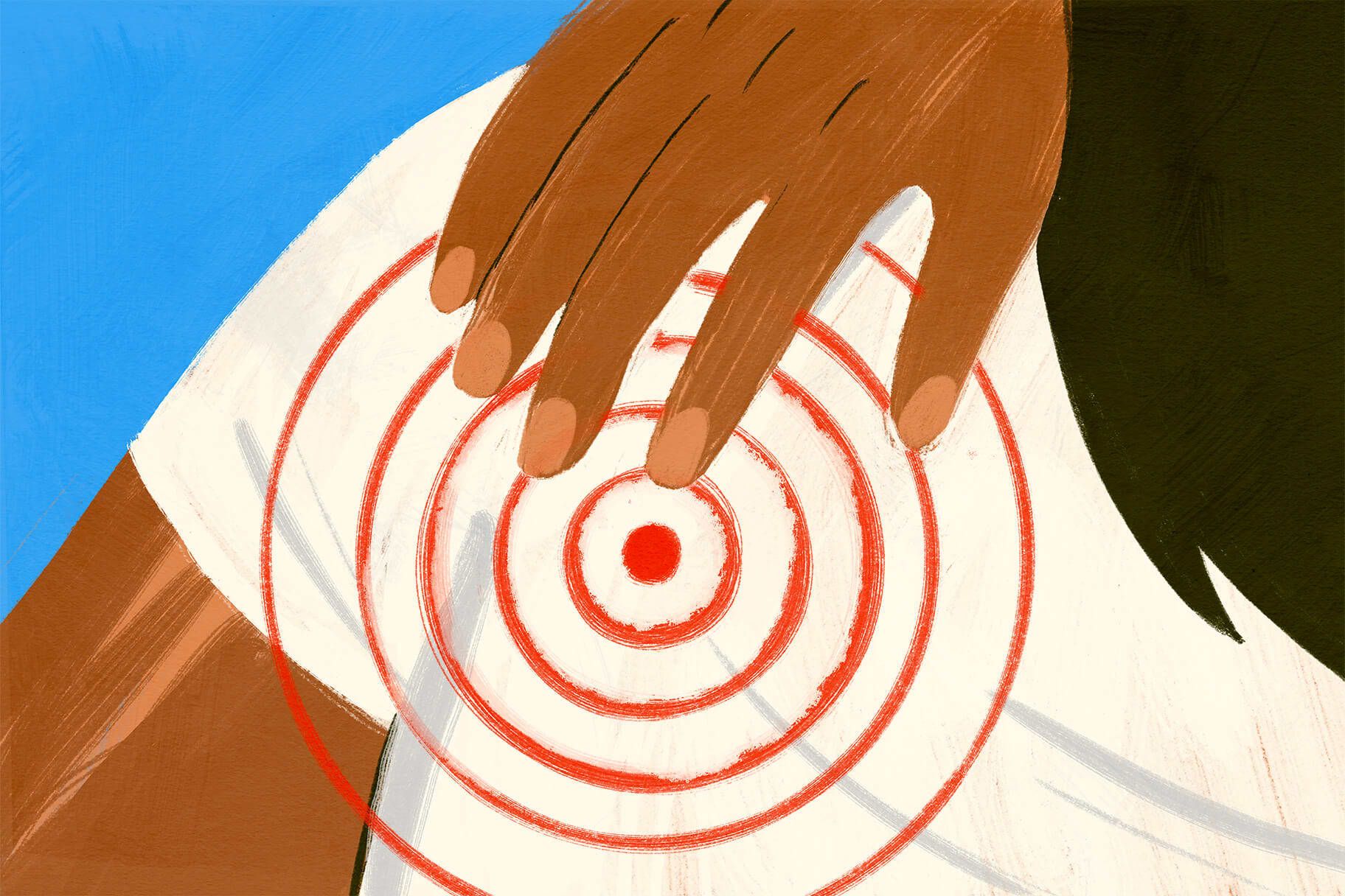 What Are Trigger Points—And How Can They Be Treated?