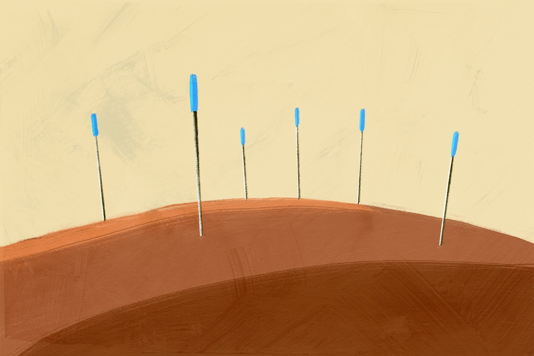 What Are Trigger Points—And How Can They Be Treated?