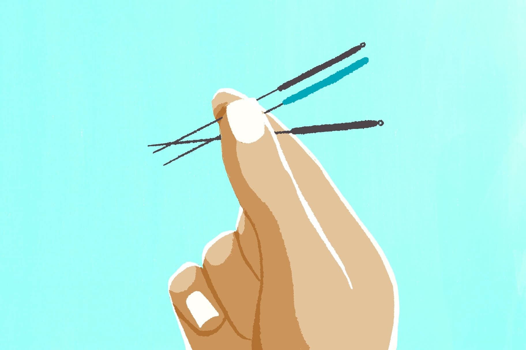 Dry Needling vs. Acupuncture: Everything You Need to Know